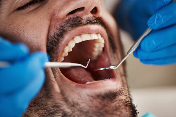 Best Emergency Treatment for Oral Infections in Pierz, MN